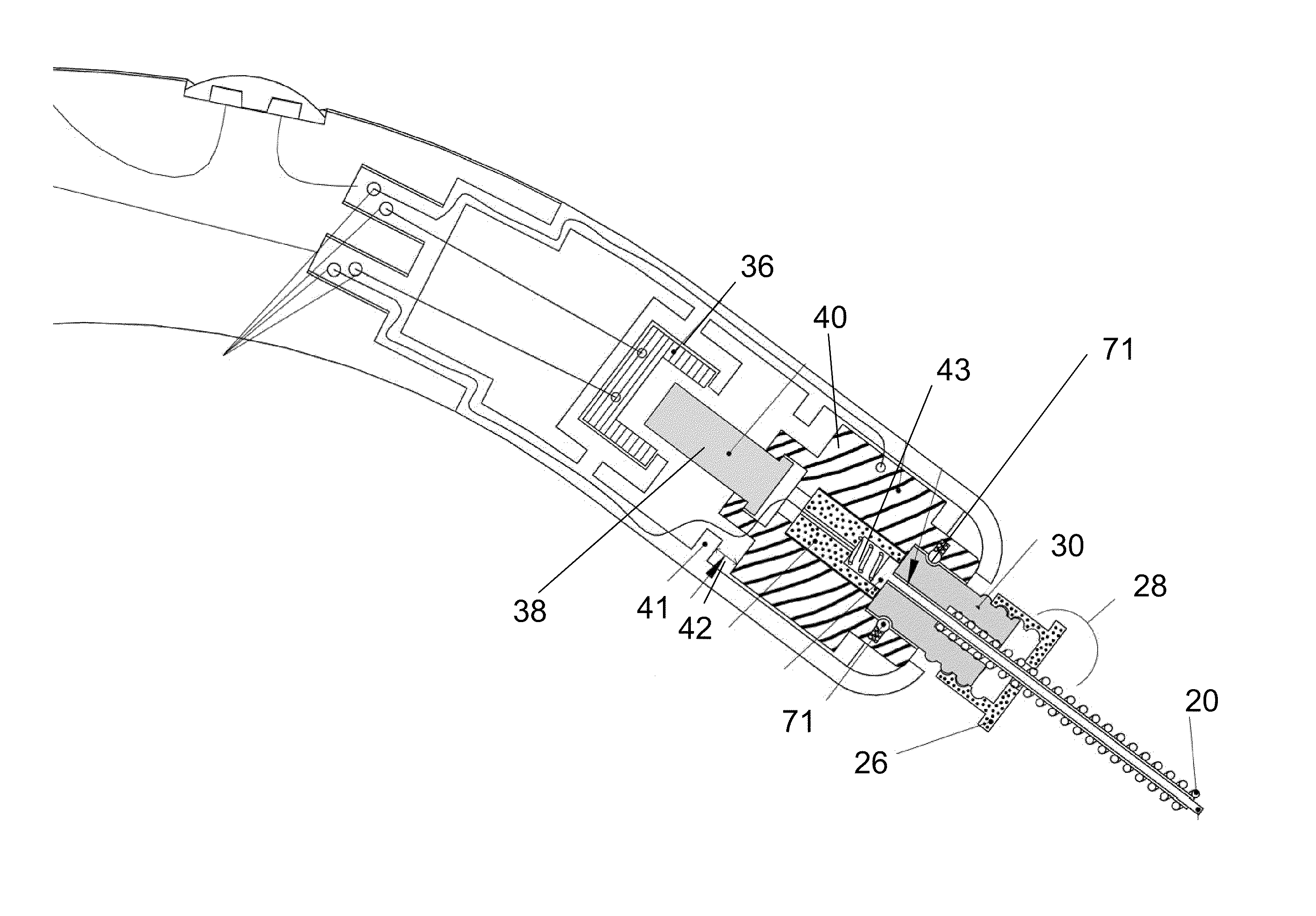 Device and method for dental cavity treatment