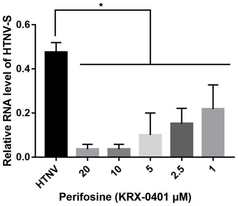 Application of Perifosine to preparation of anti-Hantaan virus drug