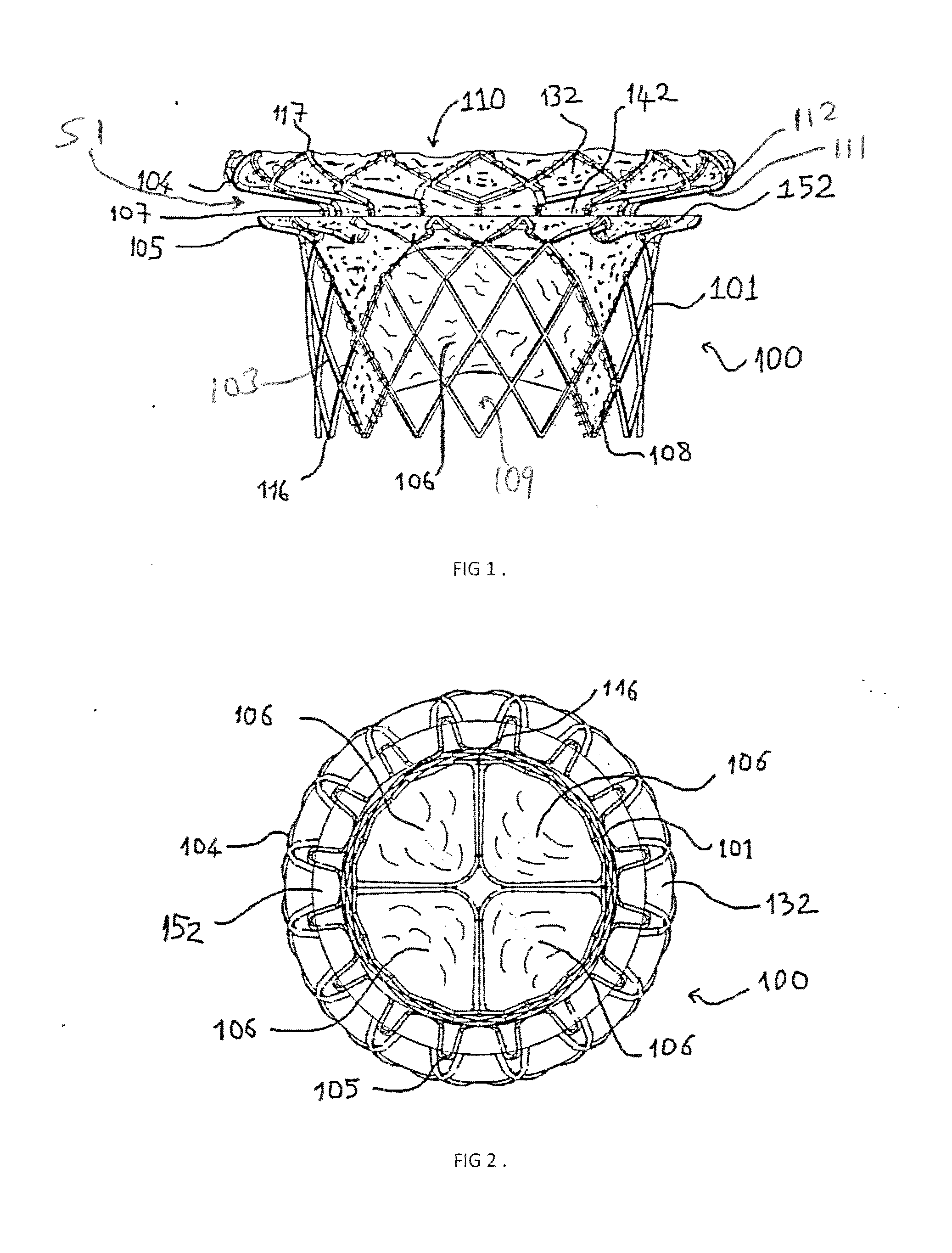 Heart Valve Assembly