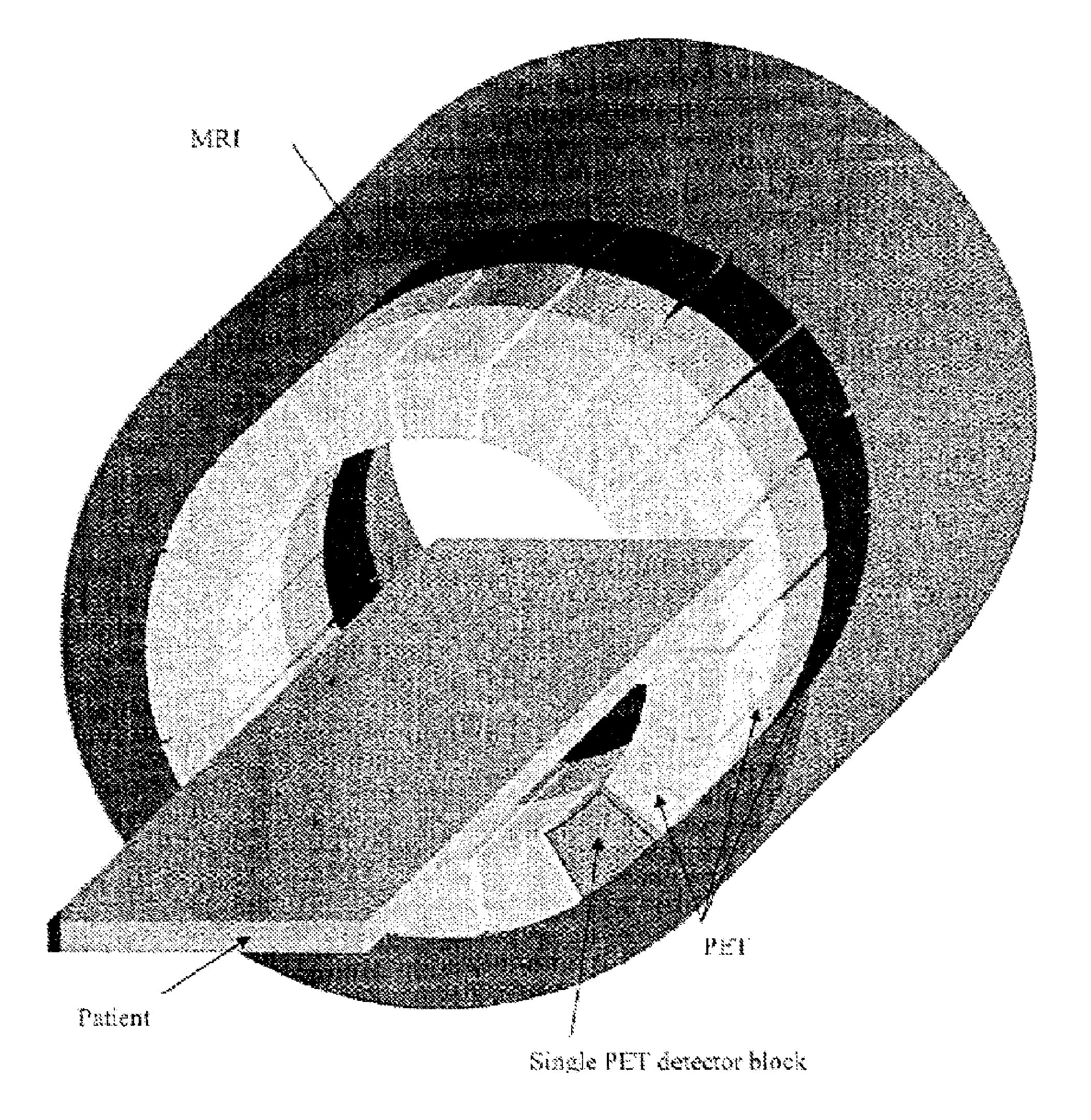 Combined PET/MR imaging system and APD-based pet detector for use in simultaneous PET/MR imaging