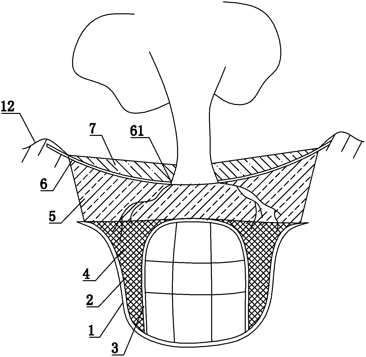 Plant water-storage bottom irrigation system