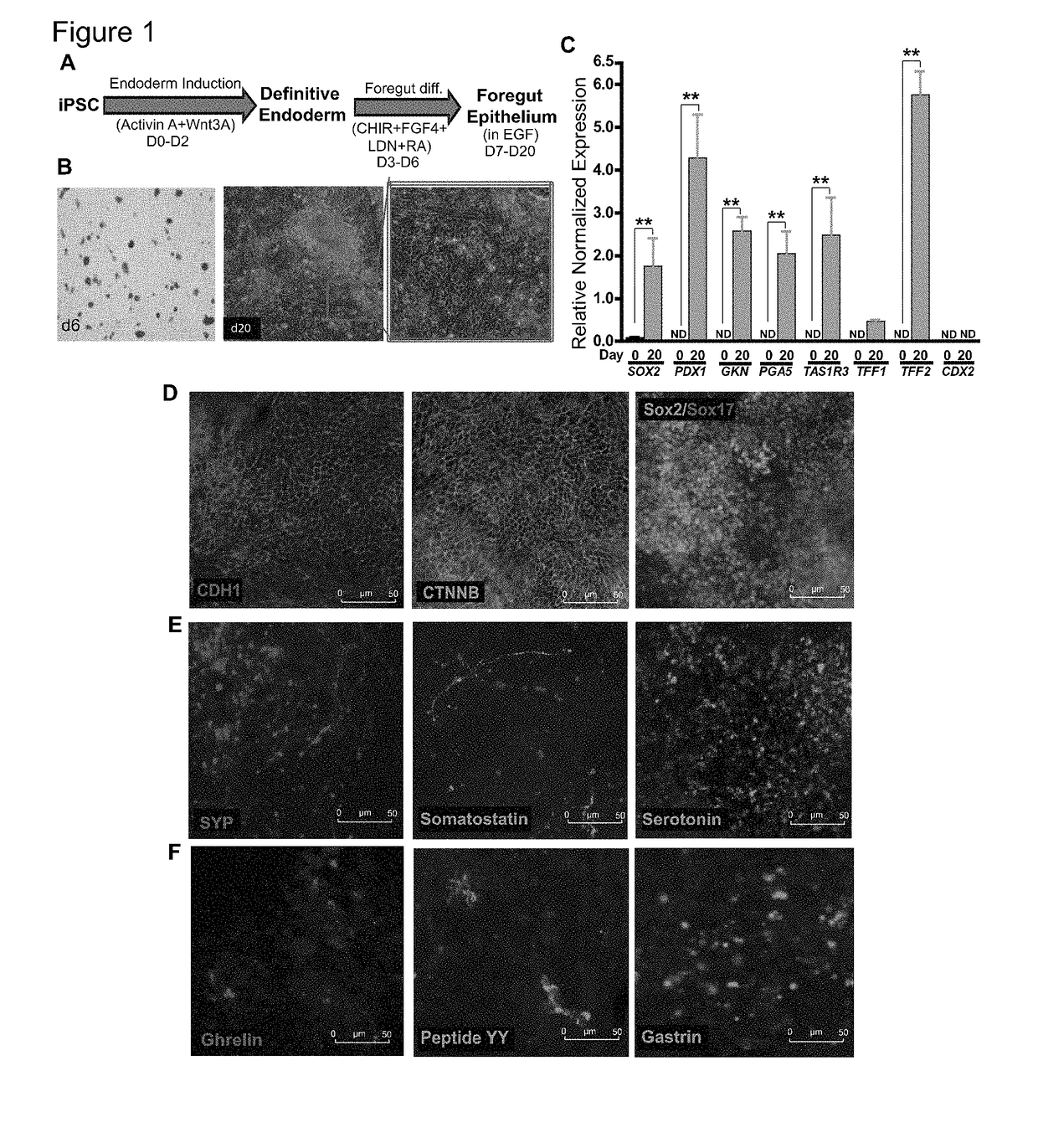 Systems and methods for growth of intestinal cells in microfluidic devices