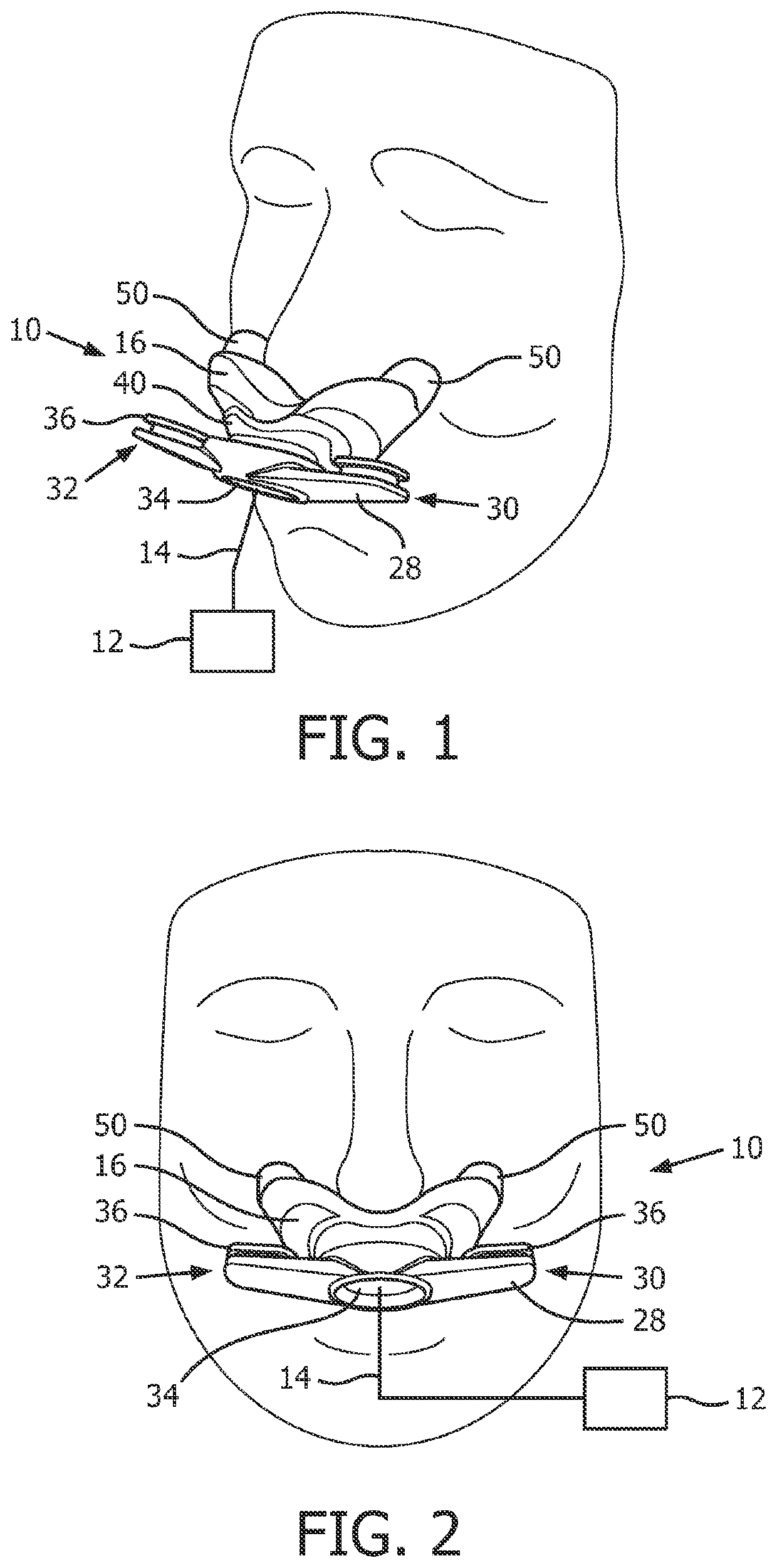 Stabilized mask