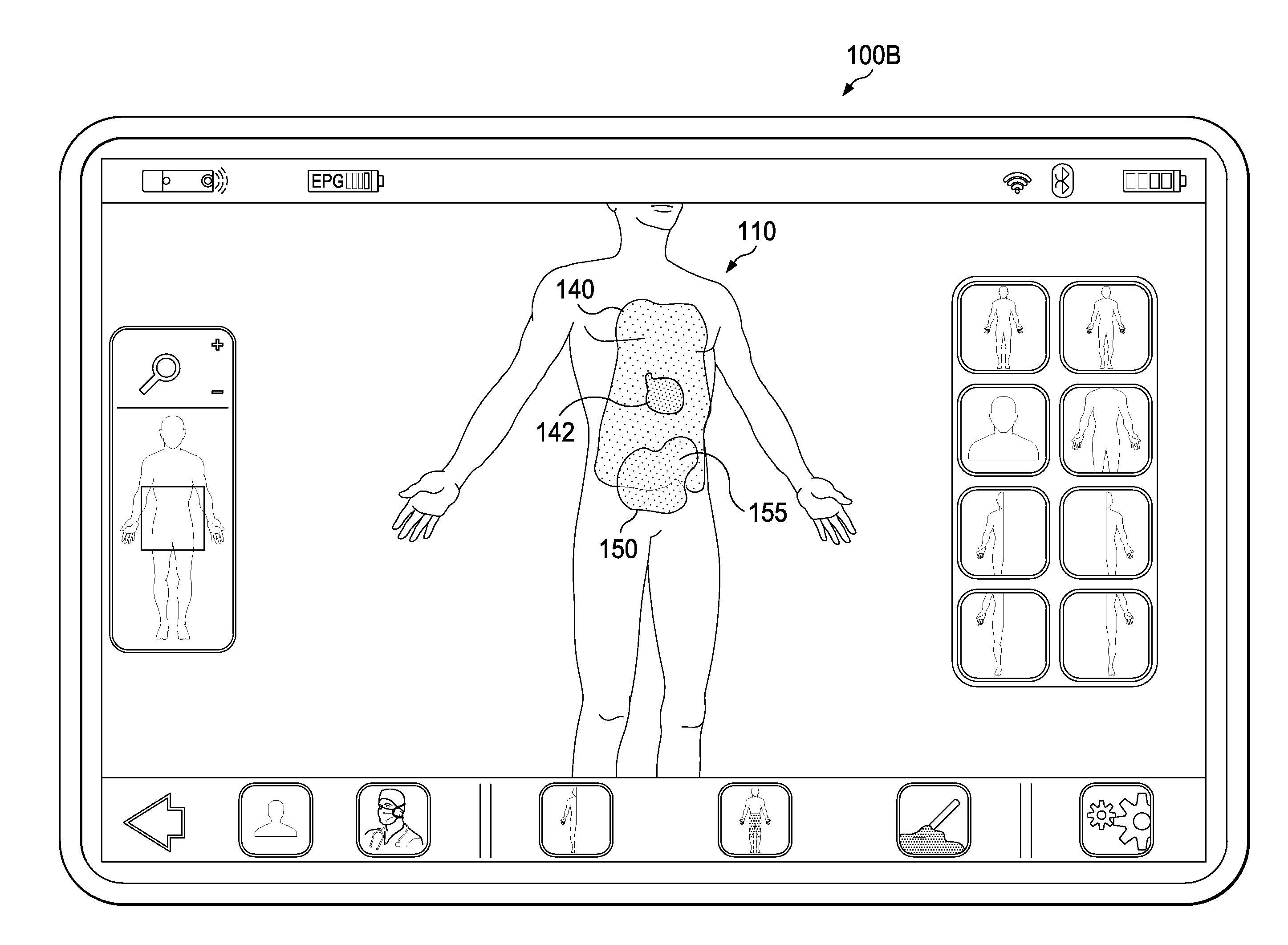 System and Method of Compressing Medical Maps for Pulse Generator or Database Storage