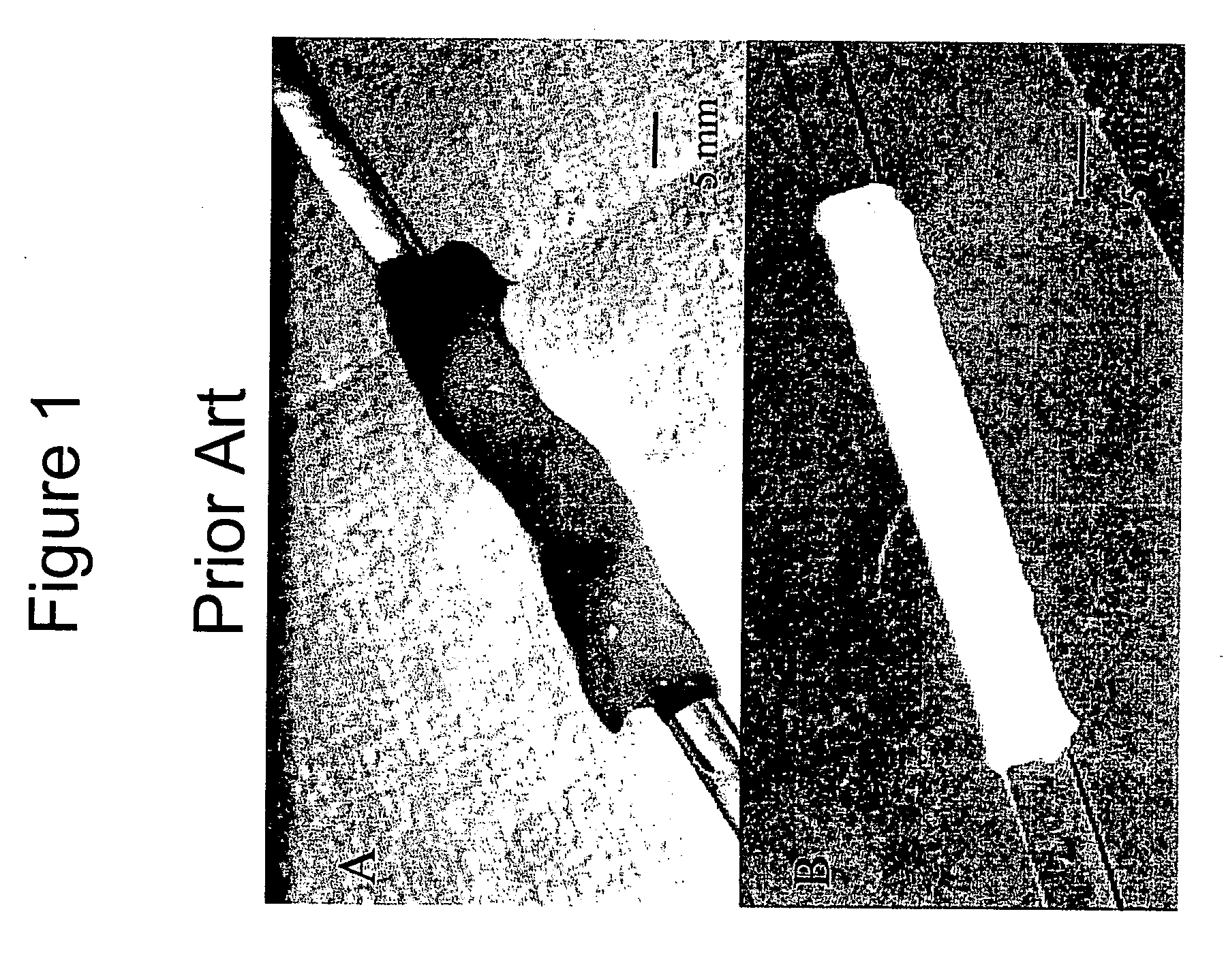 Decellularized grafts from umbilical cord vessels and process for preparing and using same