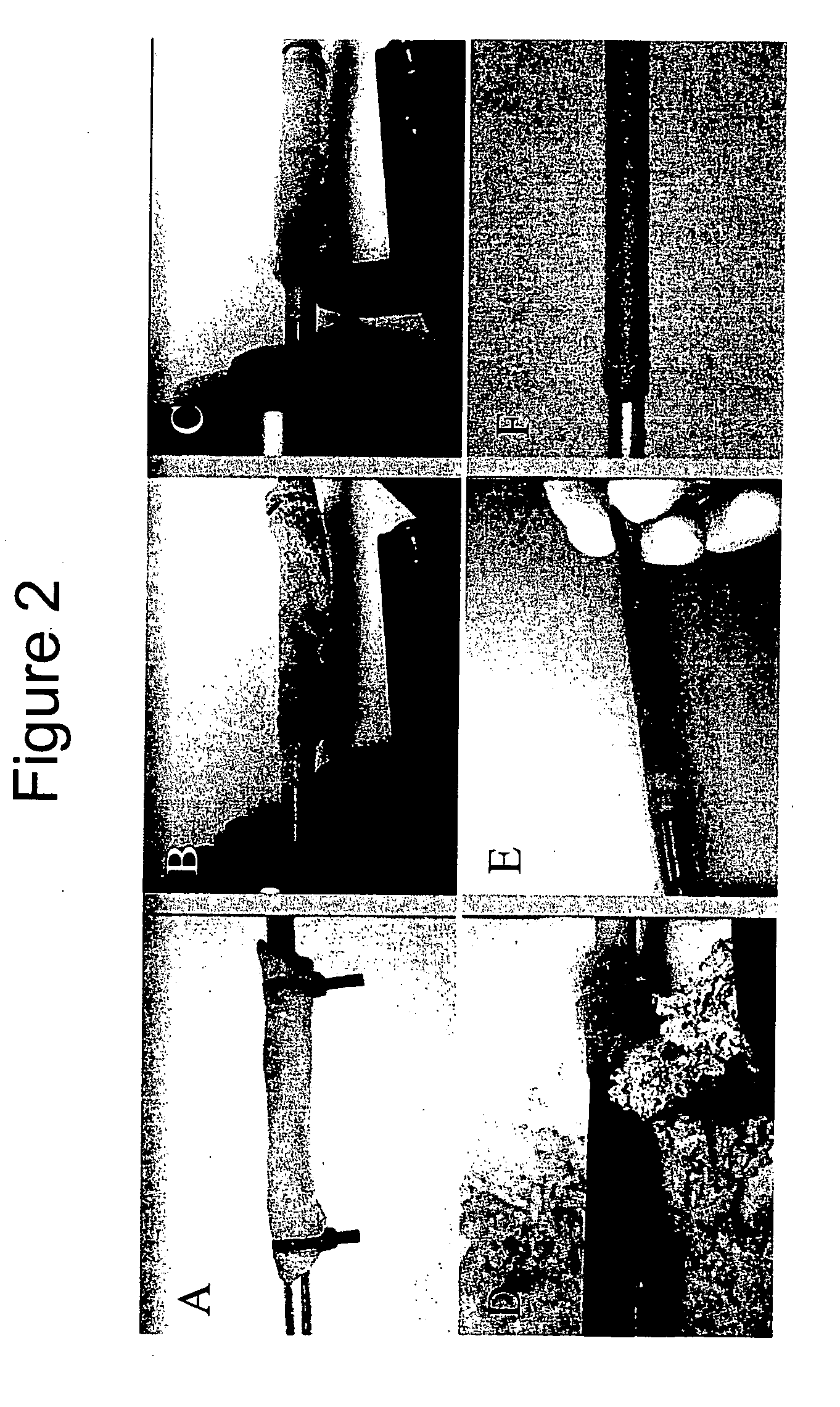 Decellularized grafts from umbilical cord vessels and process for preparing and using same