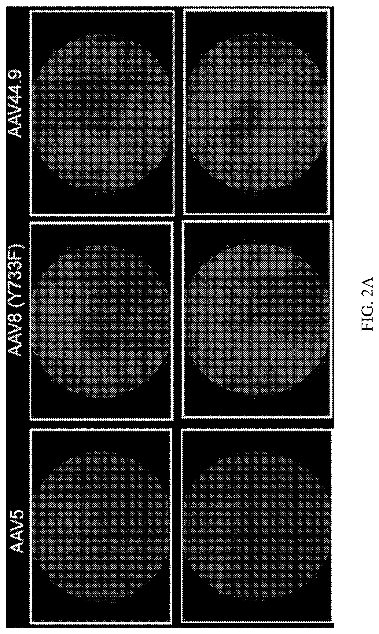 Highly efficient transduction and lateral spread in the retina by a novel aav virus enhanced by rational design