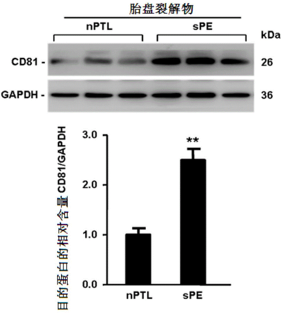 Application of membrane protein CD81 in early forecasting, parting, diagnosis and treatment of eclampsia