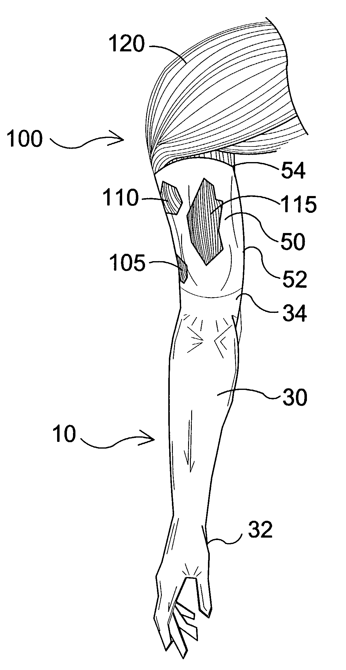 Fluid impervious cast protector