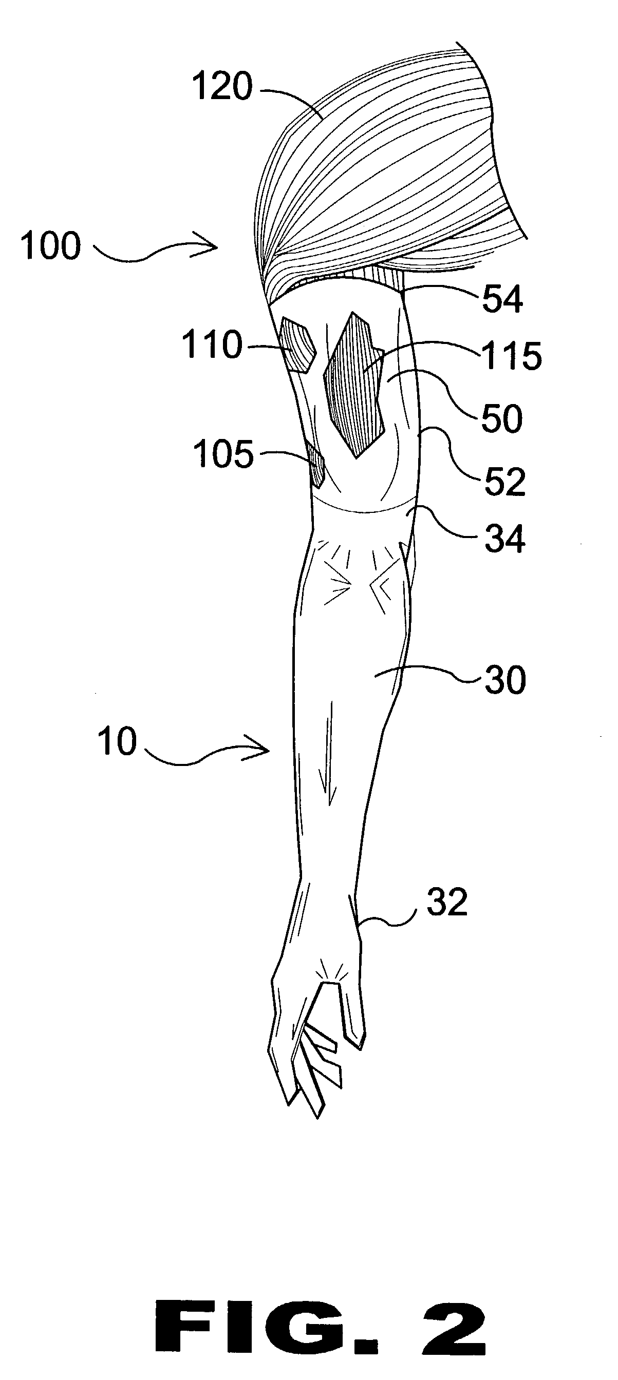 Fluid impervious cast protector