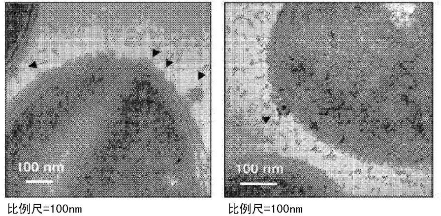 Extracellular vesicles derived from gram-positive bacteria, and use thereof