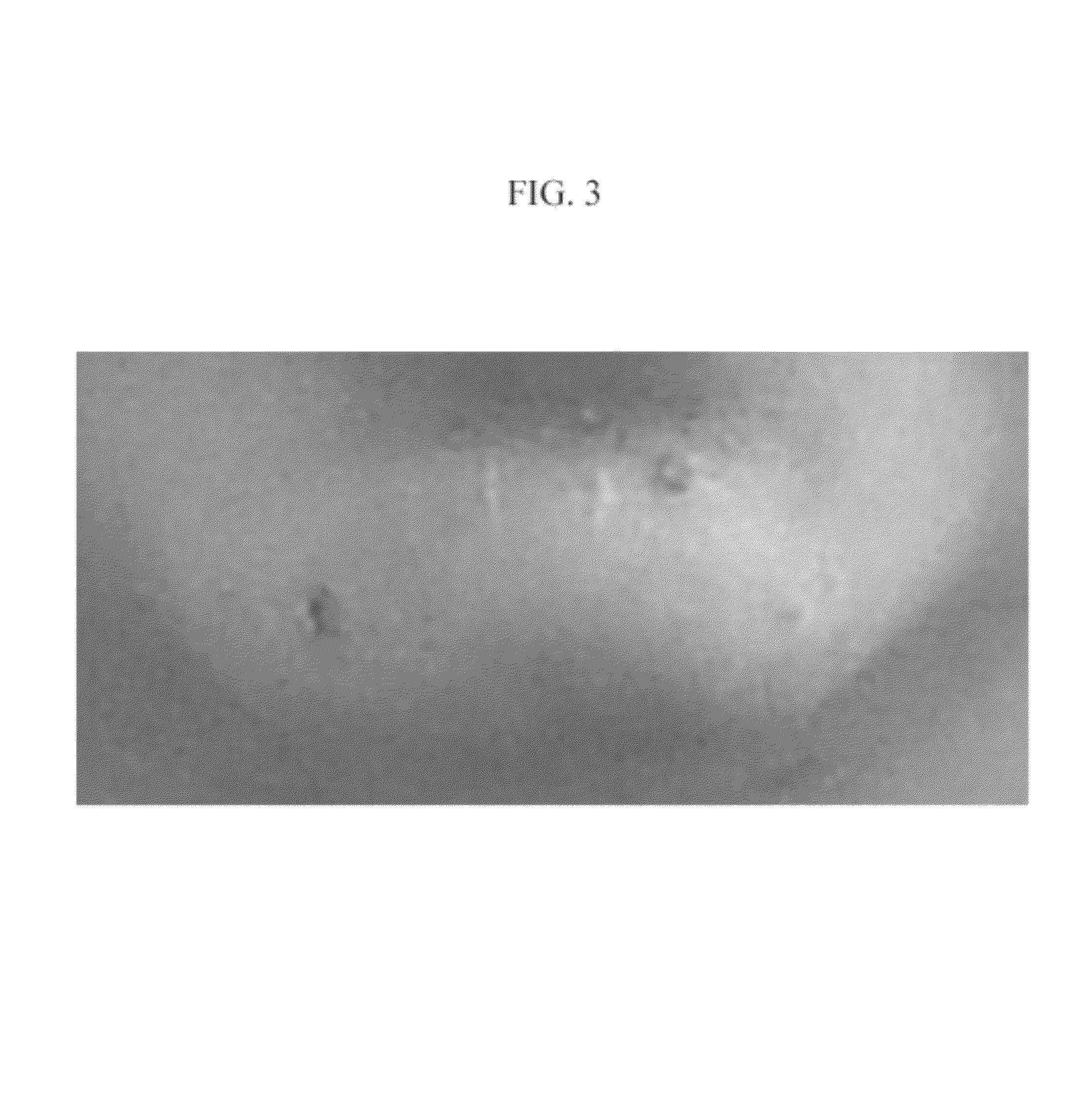 Topical base and active agent-containing compositions, and methods for improving and treating skin