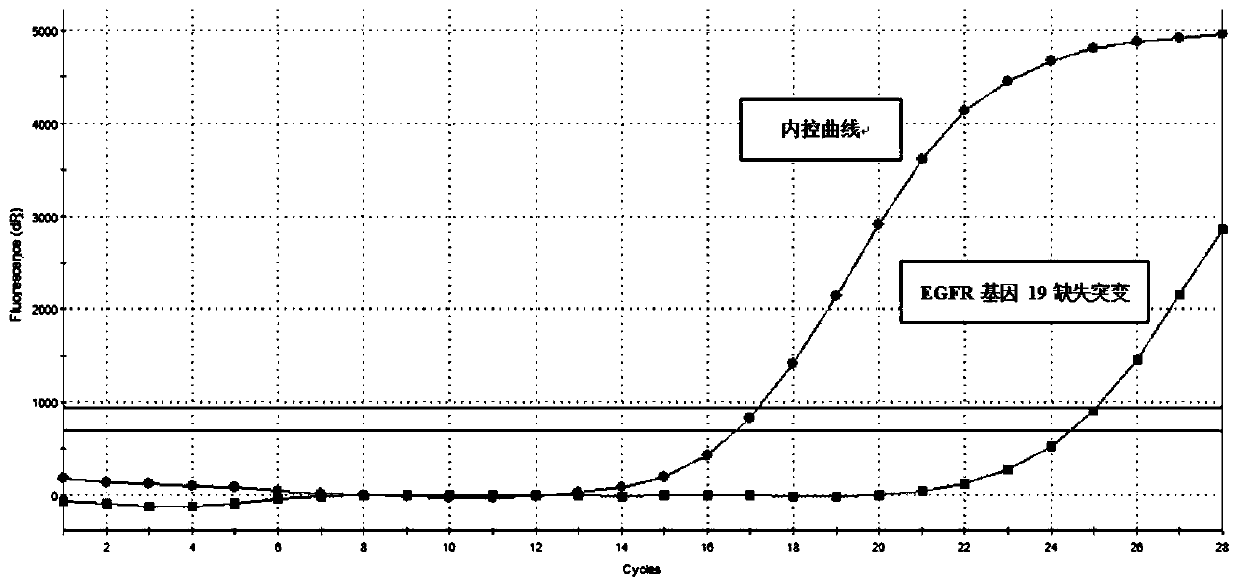 Phlegm resolving liquid for extracting free DNAs from cell-free supernatant of sputum specimen