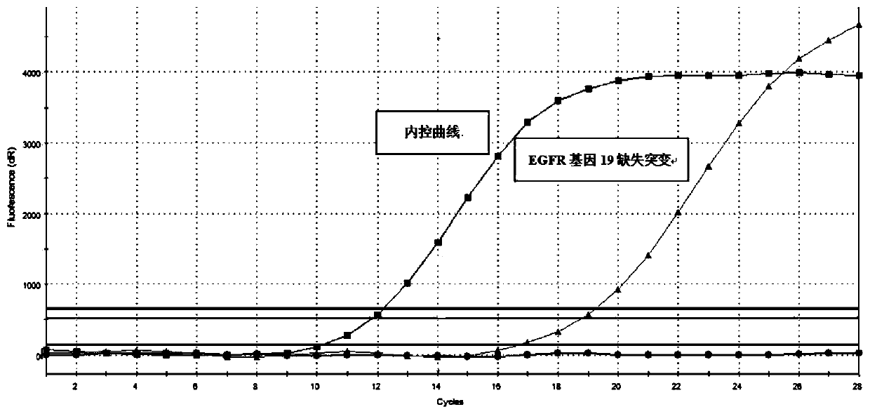 Phlegm resolving liquid for extracting free DNAs from cell-free supernatant of sputum specimen