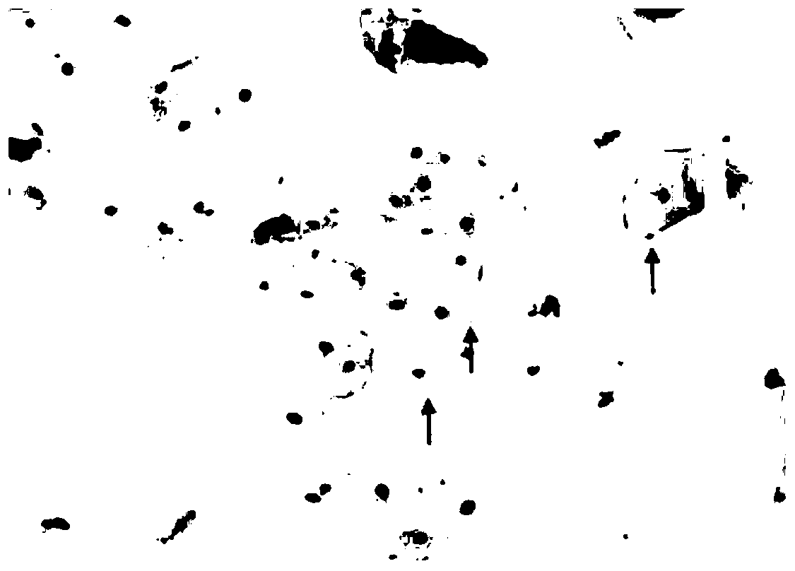 Phlegm resolving liquid for extracting free DNAs from cell-free supernatant of sputum specimen