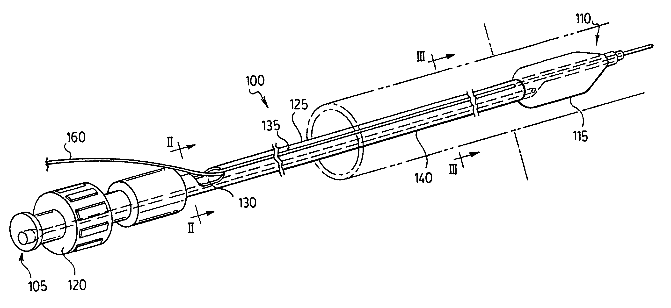 Stent delivery system and method of use