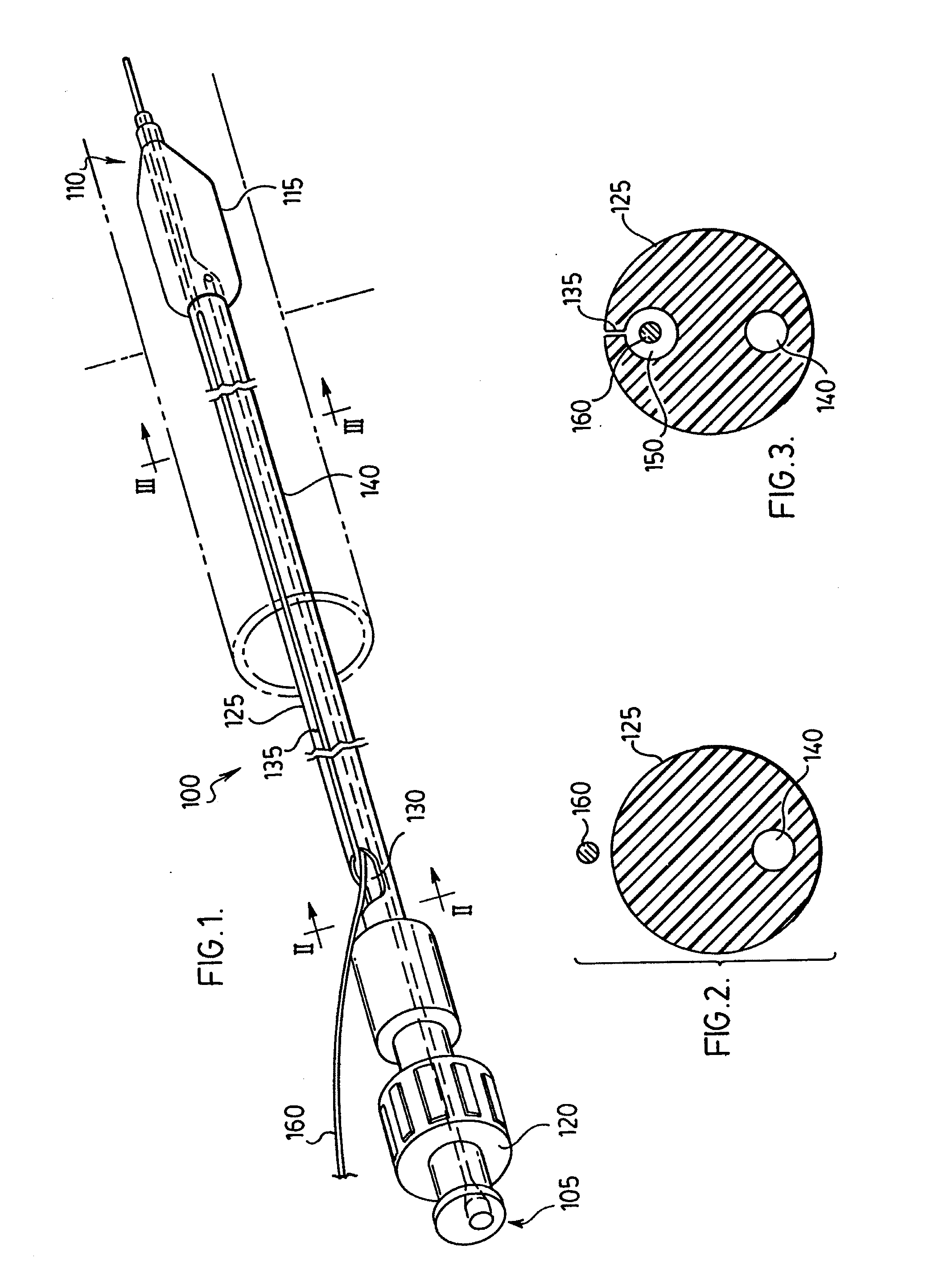 Stent delivery system and method of use