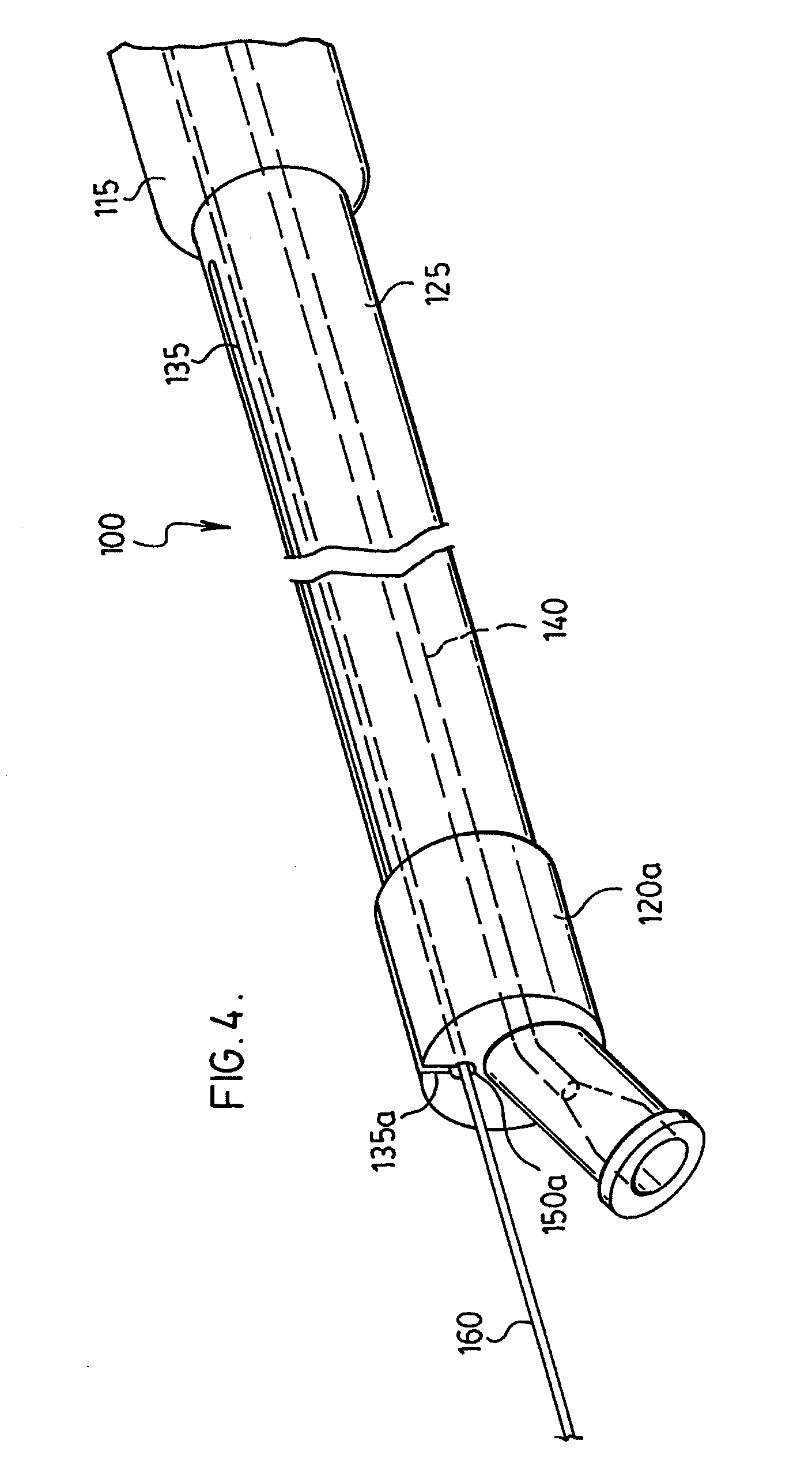 Stent delivery system and method of use