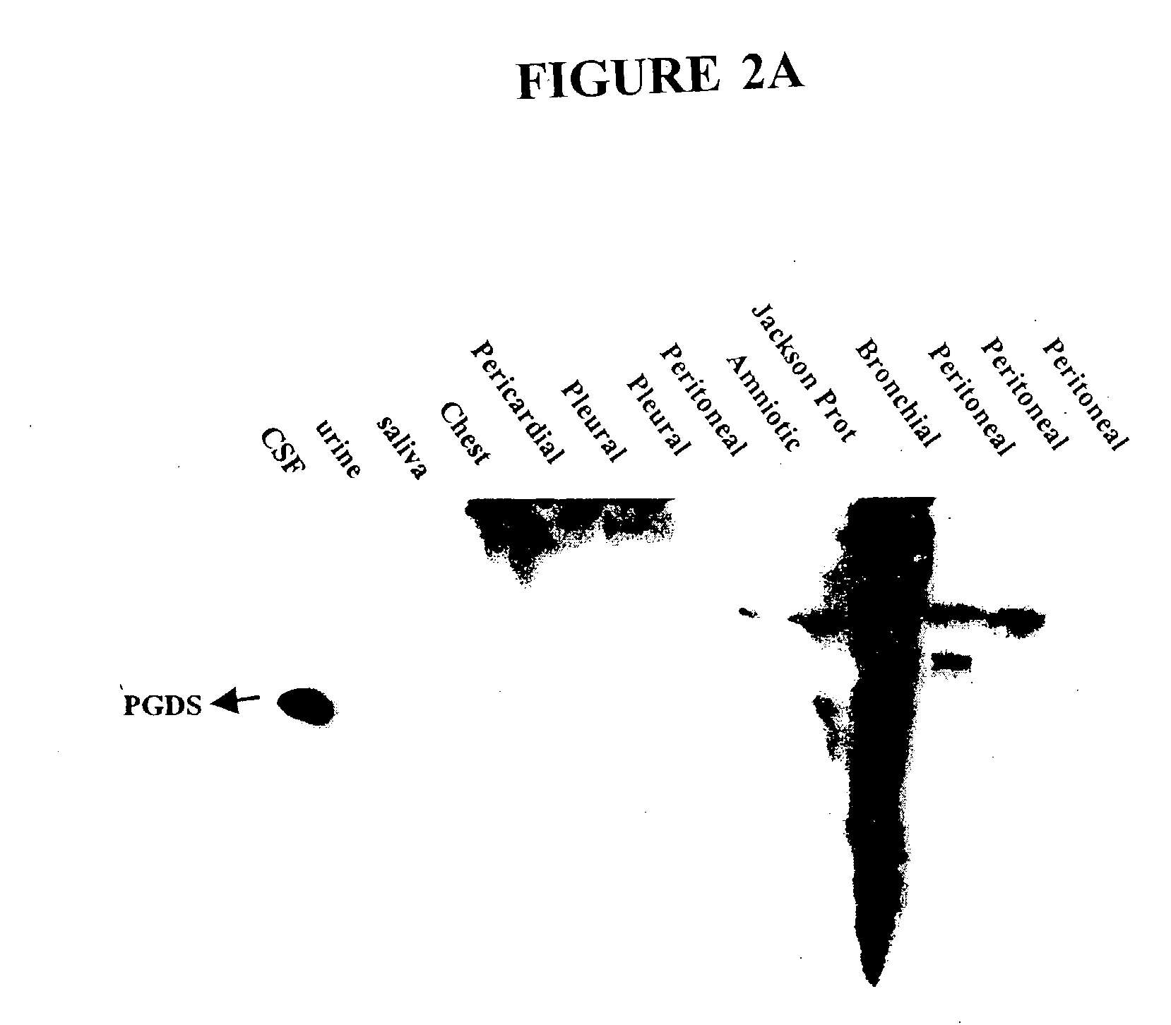 Methods and kits for detecting cerebrospinal fluid in a sample