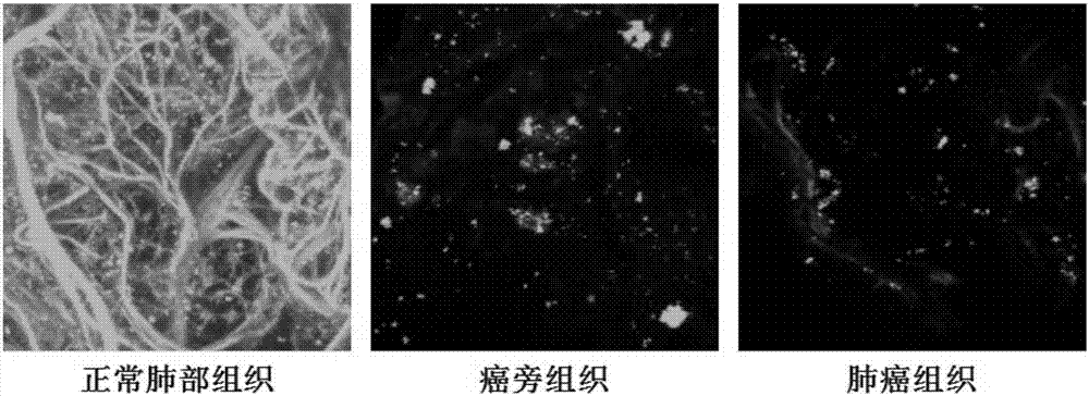 Detection method based on reduction of lung self-fluorescence as mark for detecting lung cancer tissue and application thereof