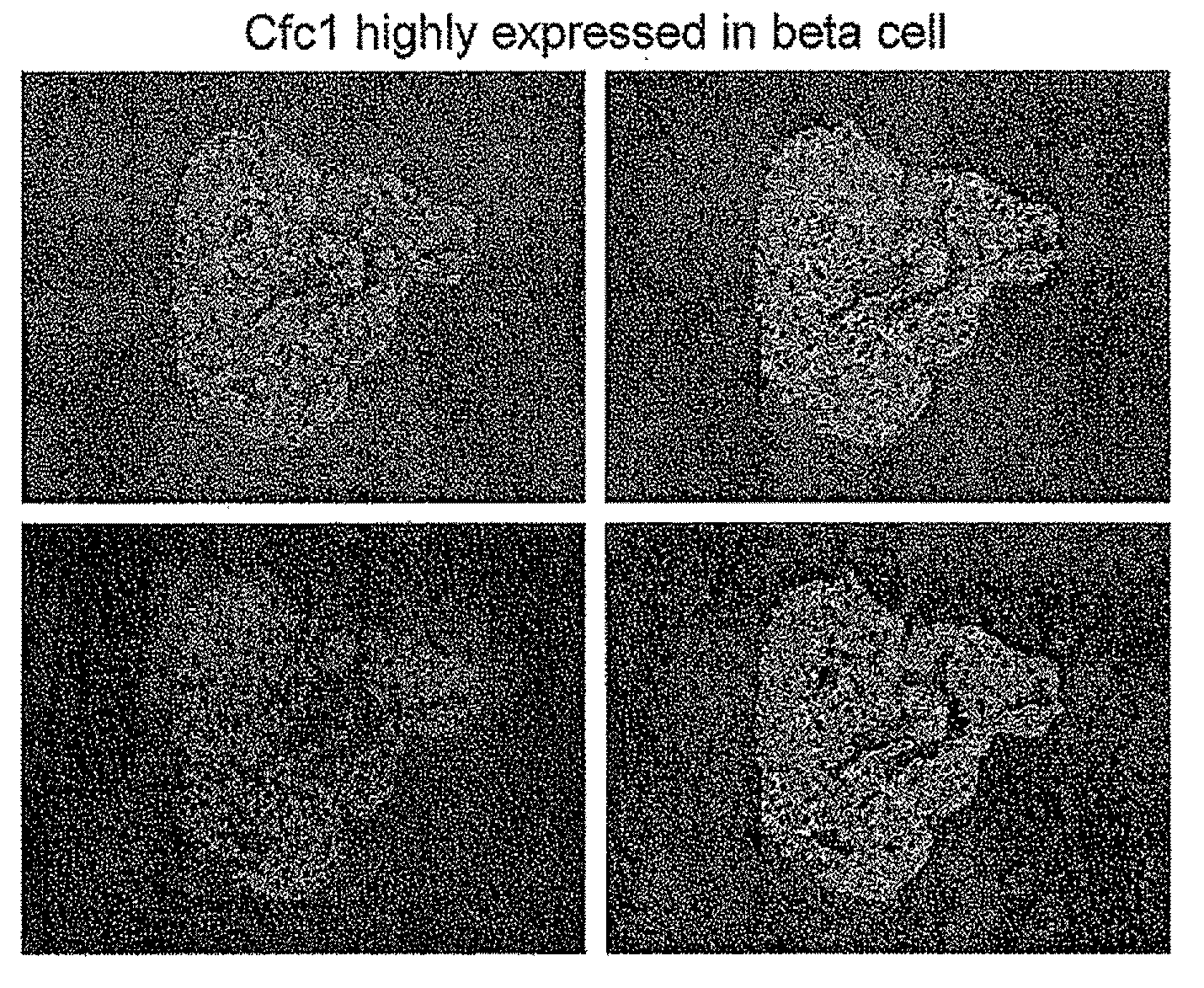 Pancreatic beta-cell mass biomarker