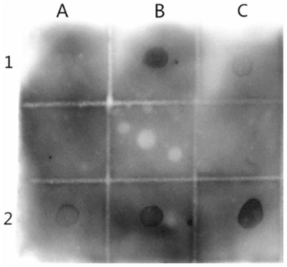 Polypeptide specifically binding to Mycoplasma pneumoniae positive serum and diagnostic kit