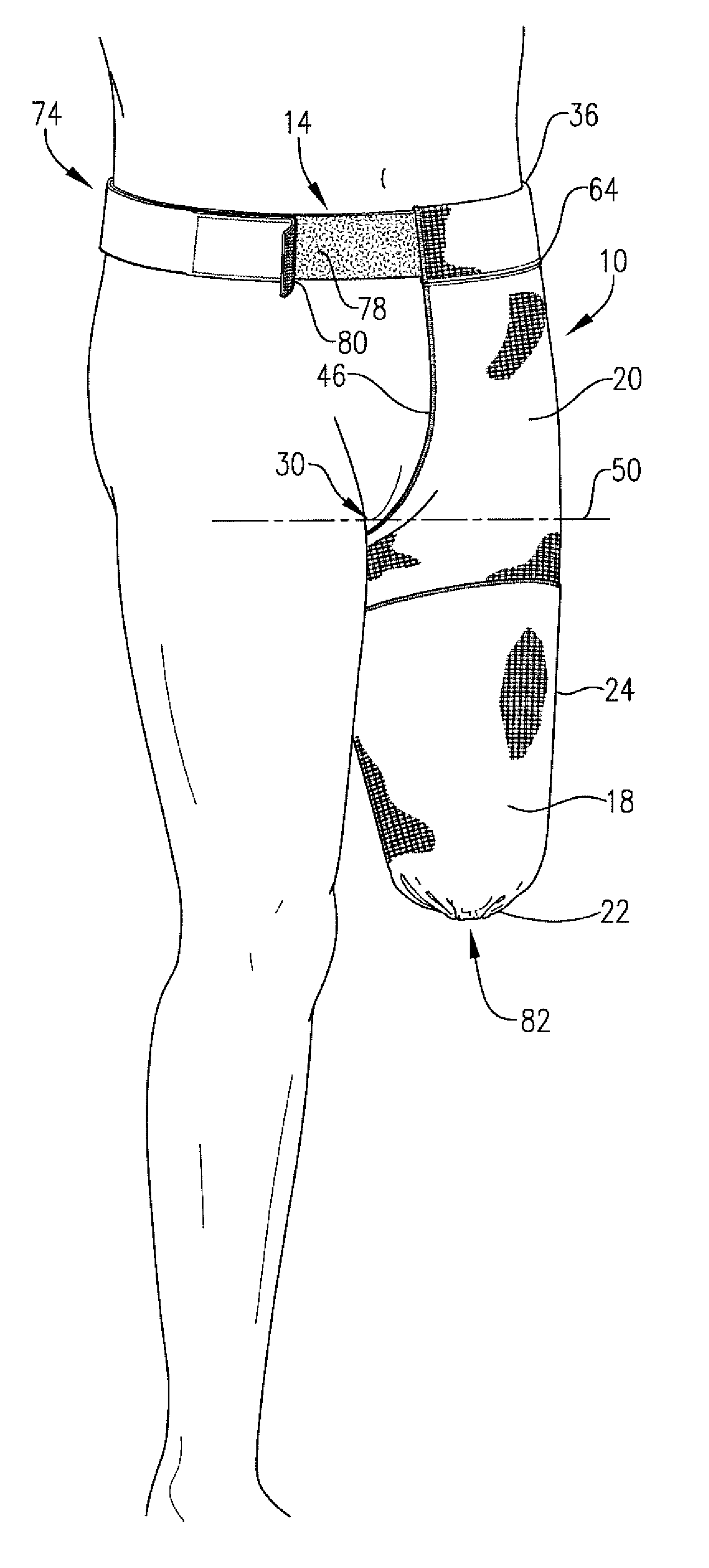 Above knee shrinker