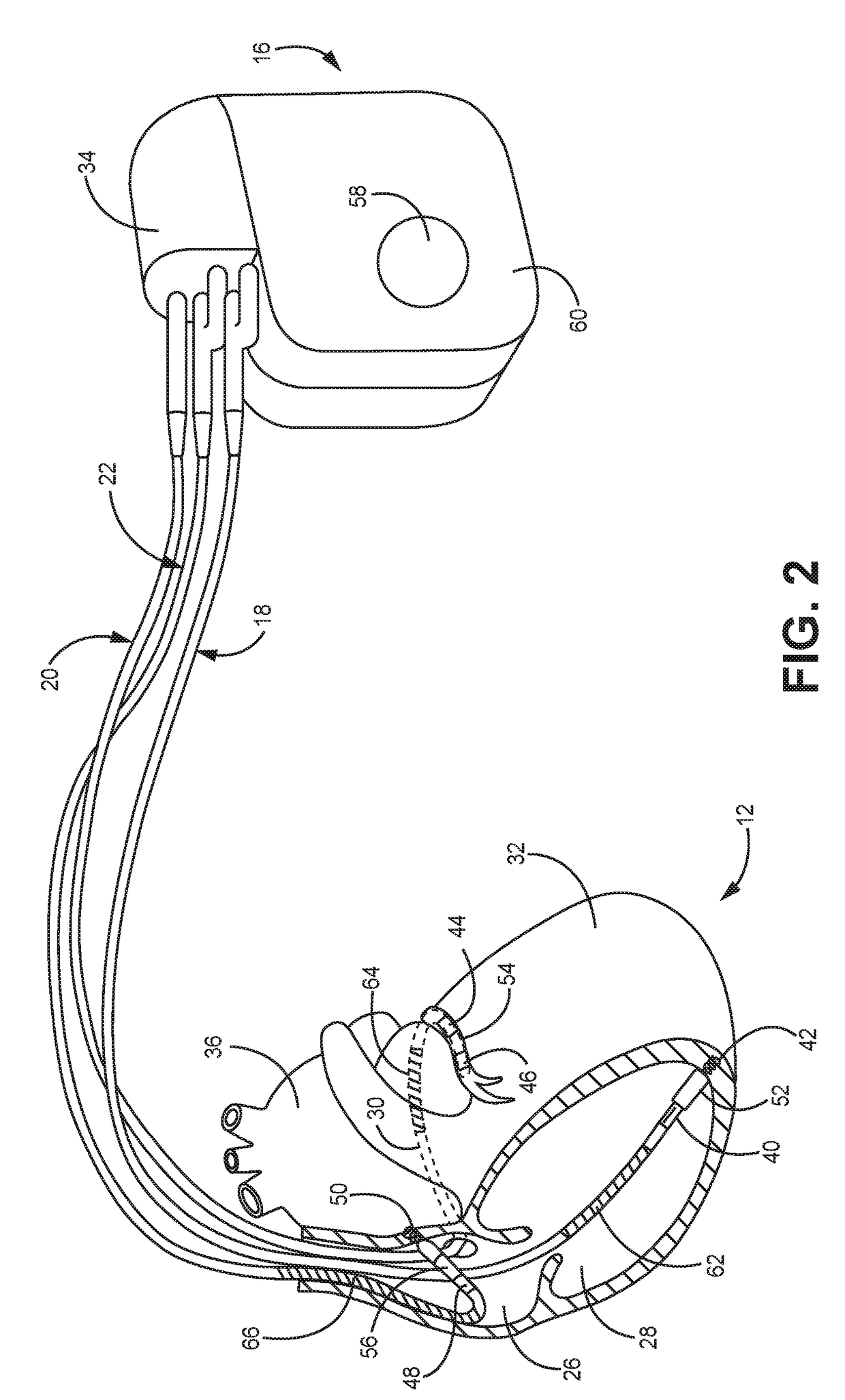 Medical system for seamless therapy adjustment