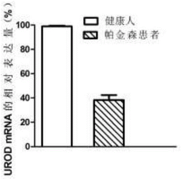 Application of biomarker in diagnosis of Parkinson