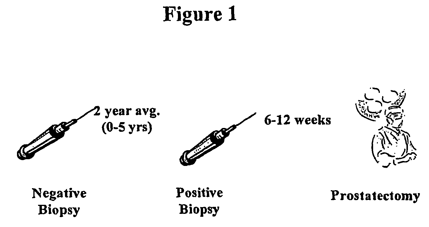 Early prostate cancer antigens (EPCA), polynucleotide sequences encoding them, and their use