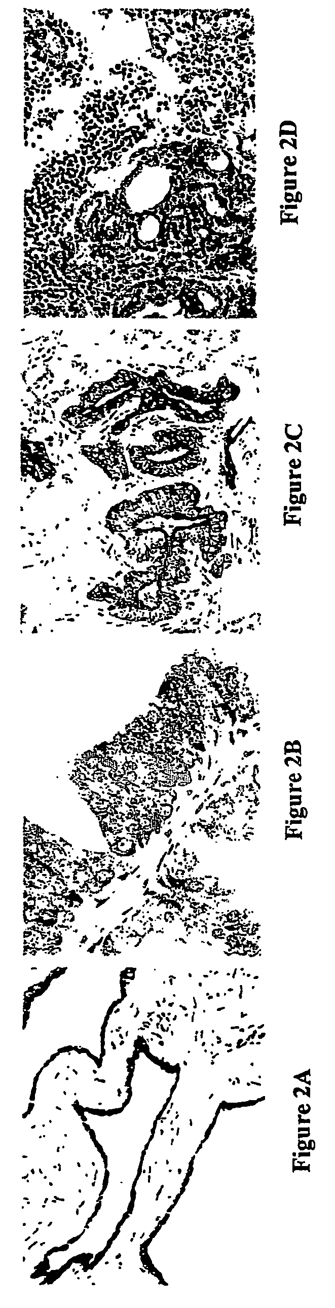 Early prostate cancer antigens (EPCA), polynucleotide sequences encoding them, and their use