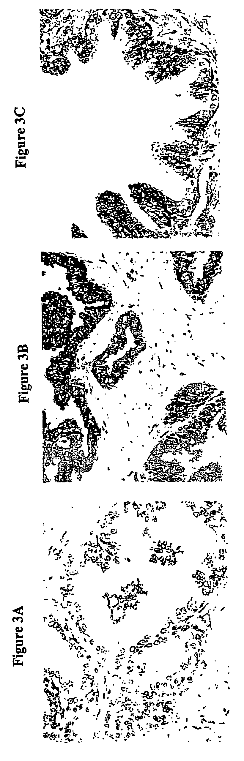 Early prostate cancer antigens (EPCA), polynucleotide sequences encoding them, and their use