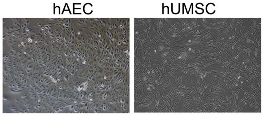 Application of stem cell conditioned medium in preparation of medicine for treating inflammatory skin