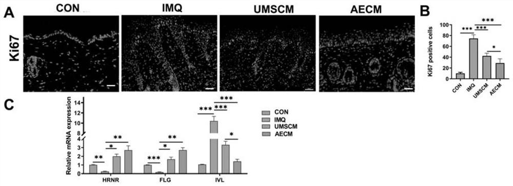 Application of stem cell conditioned medium in preparation of medicine for treating inflammatory skin