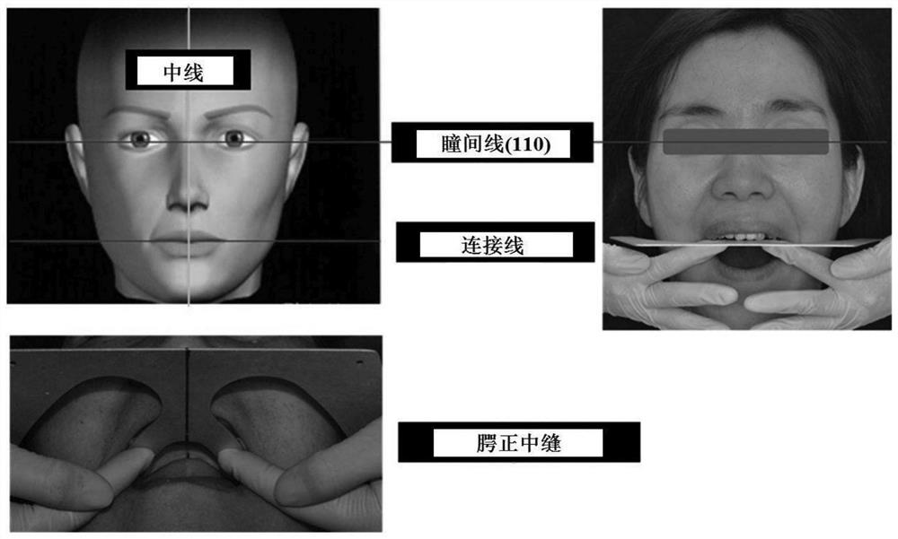 Assembly type rod for recording occlusal plane