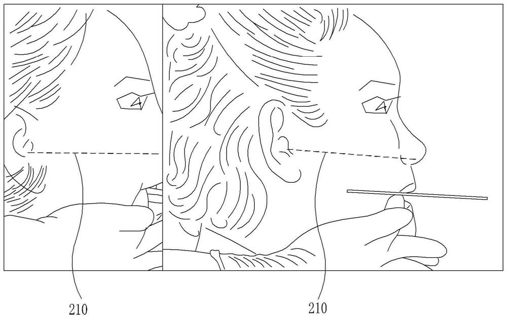 Assembly type rod for recording occlusal plane