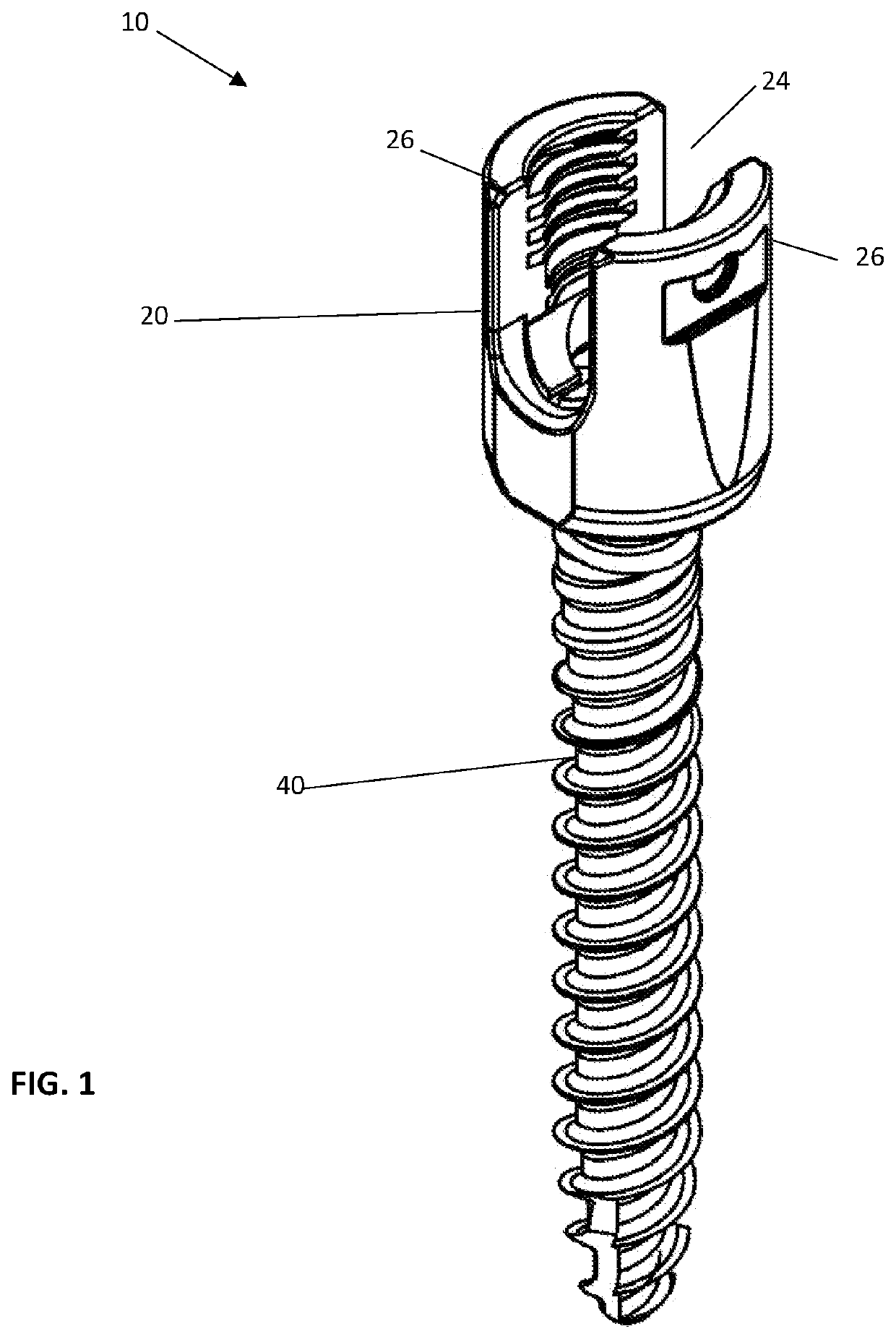 Modular polyaxial pedicle screw assembly with split ring