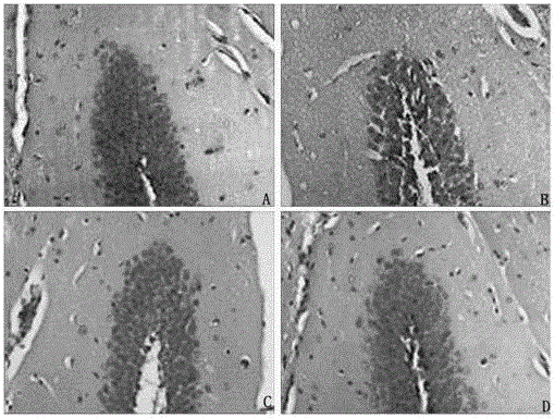 Pampasia extract and its application in the preparation of drugs for preventing and treating Alzheimer's disease