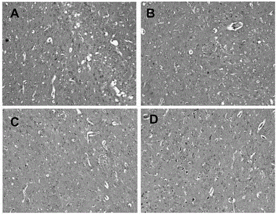 Pampasia extract and its application in the preparation of drugs for preventing and treating Alzheimer's disease