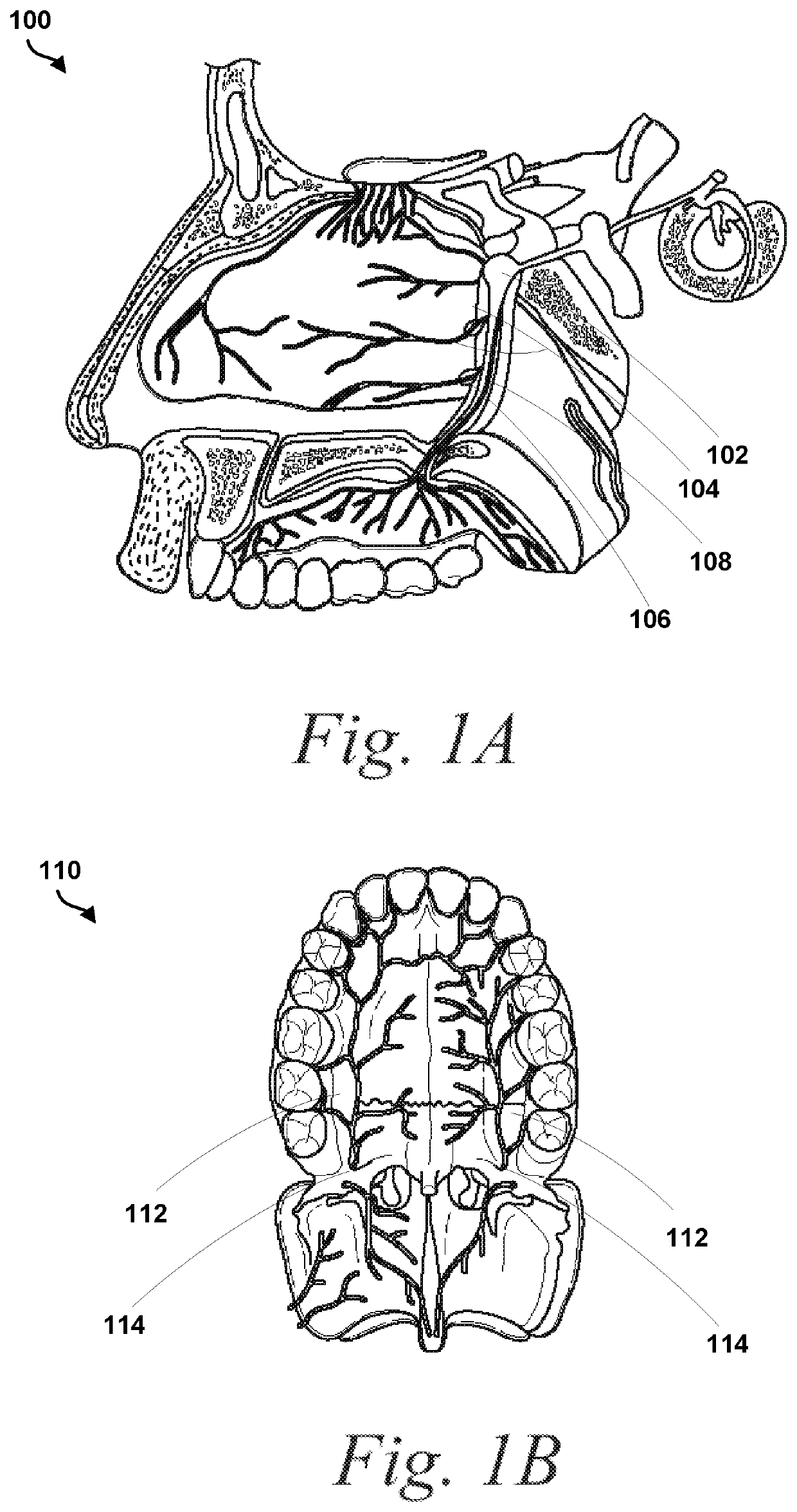 Systems and Methods for Improved Treatment of Headache