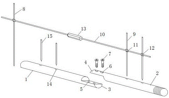 A minimally invasive intramedullary fixation device for clavicle fractures