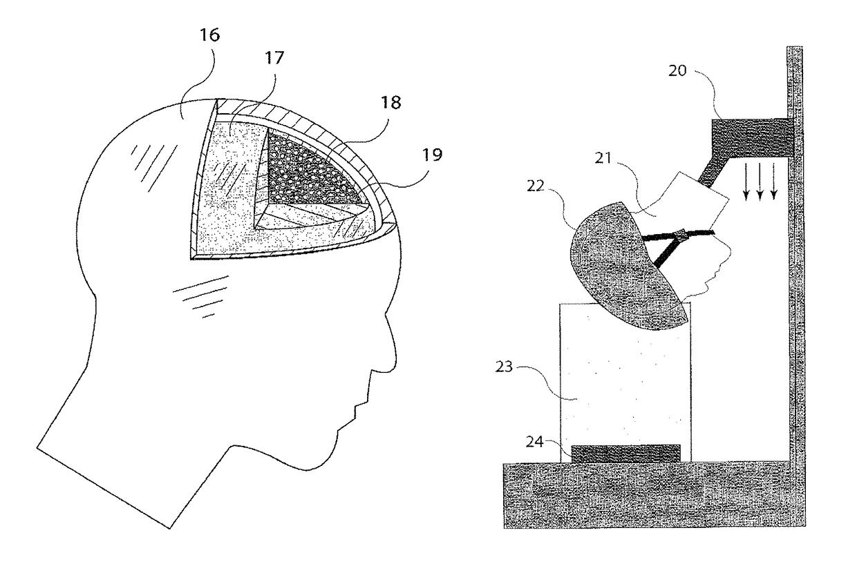 Diagnostic for in situ deformation and strain measurements applicable to traumatic internal injury investigation and prevention