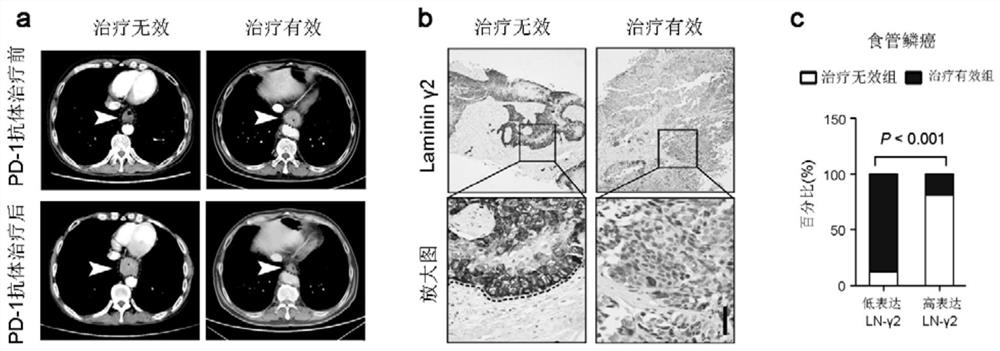 A kit for predicting efficacy of immune checkpoint inhibitor on cancer patients