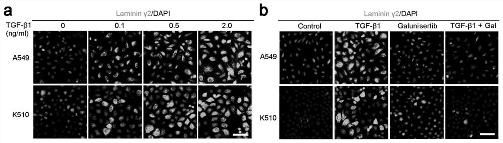 A kit for predicting efficacy of immune checkpoint inhibitor on cancer patients