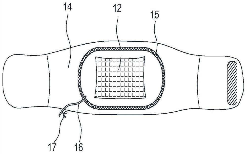 Non-layered molybdenum nanosheet/graphene-based traditional Chinese medicine hot compress device