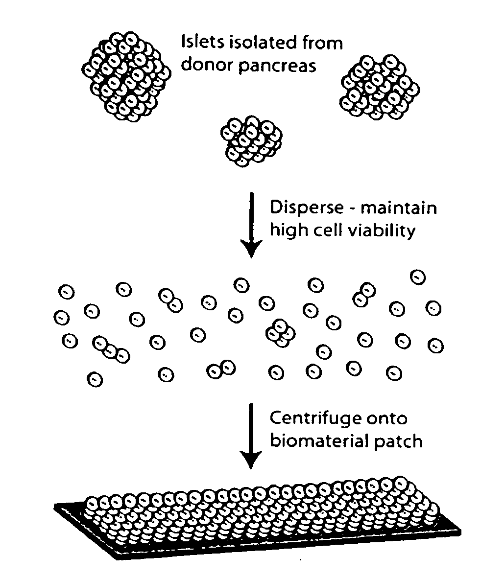 Templated islet cells and small islet cell clusters for diabetes treatment