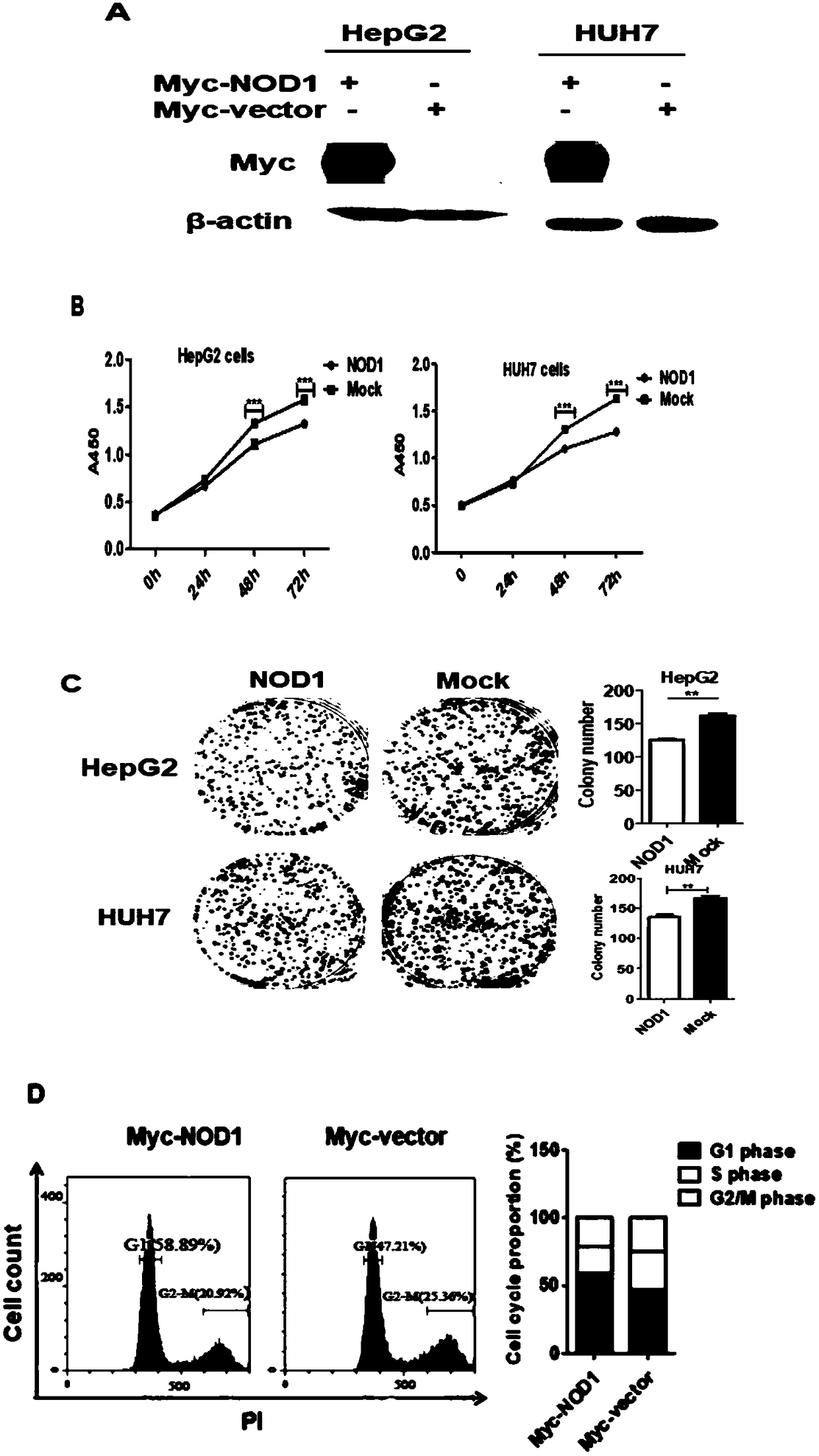 Application of NOD1 to preparation of products for inhibiting tumor SRC signal path