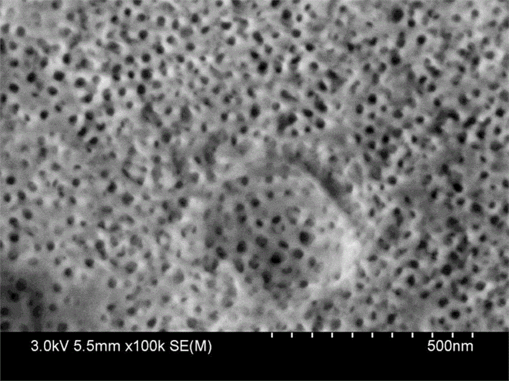 Method for microporous treatment of metal surface