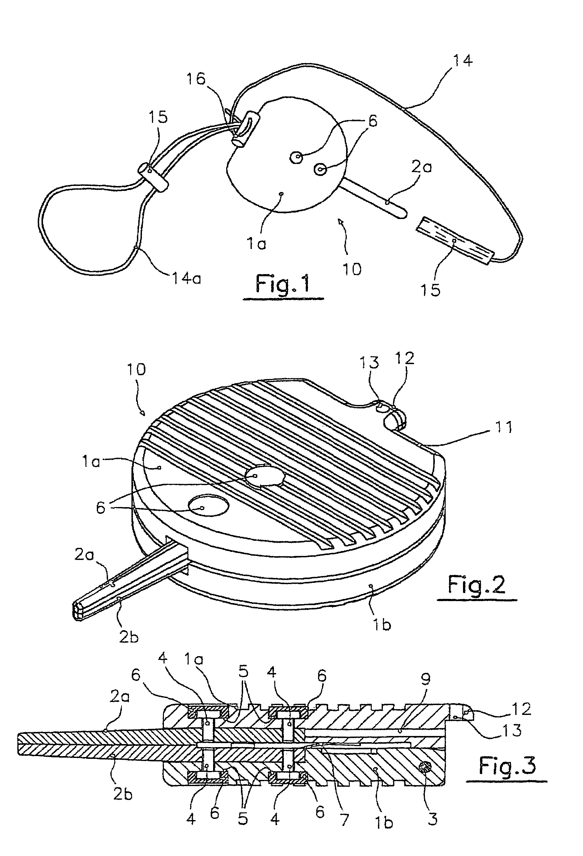 Auxiliary forceps for hand-assisted laparoscopic surgery (HALS)