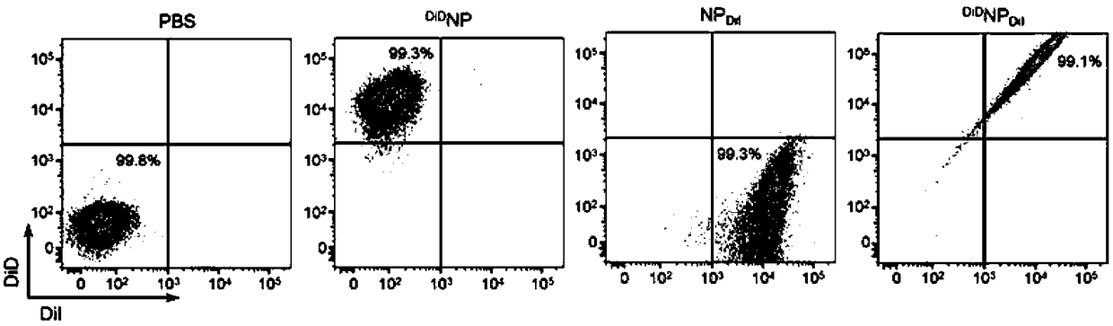 Application of nanometer drug-loading system in preparation of medicines for curing refractory thyroid cancer